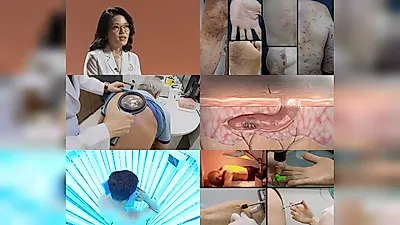 EBS『名医』キム・ヘウォン教授、9年続く難治性のかゆみの原因を明かす（25日夜9時55分）